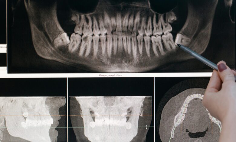 Jaw Surgery And Why It Matters